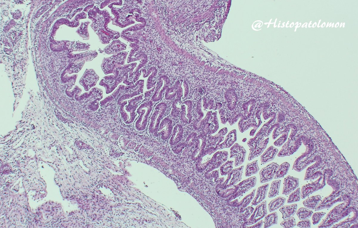 The correct official answer is: No, NoIsolated lymphoid follicles appear at 15-21 weeks and Peyer's patches at 25-29 weeks. As you can see, there is no muscularis mucosae (week 20) but there are goblet cells (week 7)colon (orange), ileum (blue), appendix (black), valve (red)
