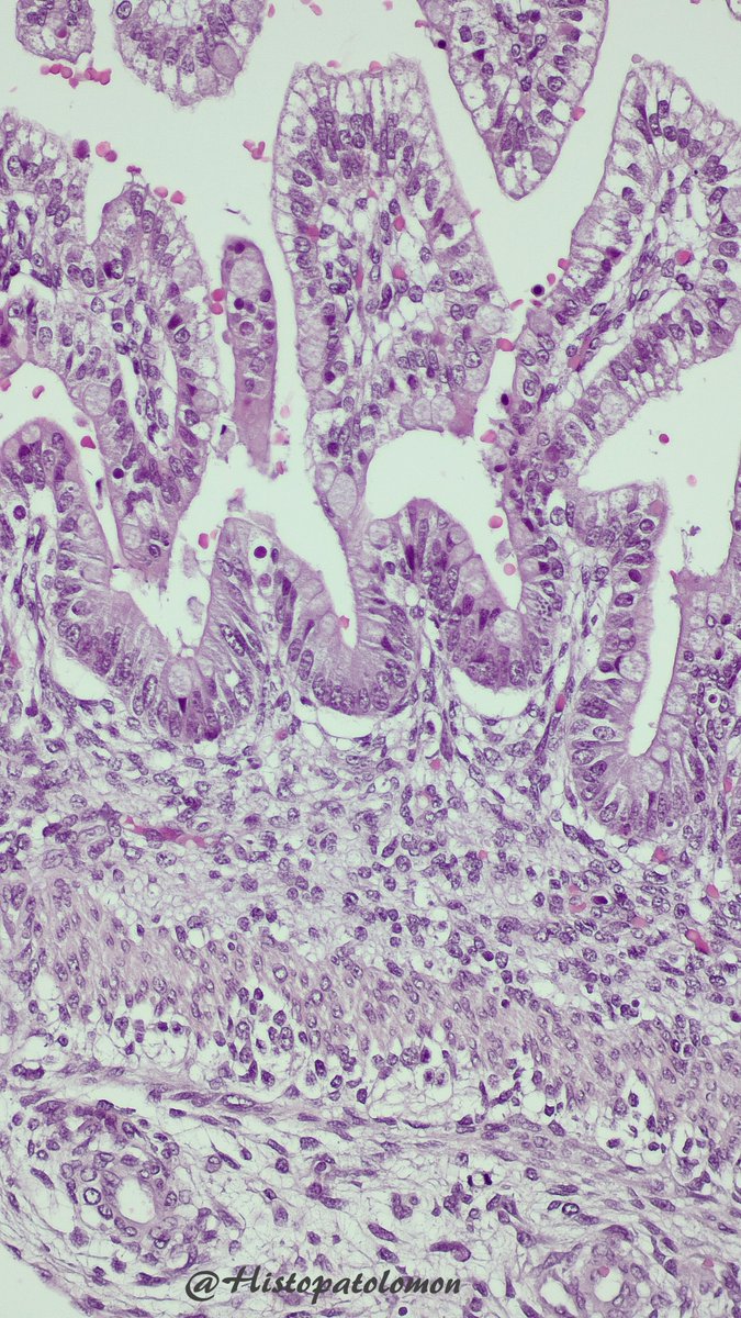 The correct official answer is: No, NoIsolated lymphoid follicles appear at 15-21 weeks and Peyer's patches at 25-29 weeks. As you can see, there is no muscularis mucosae (week 20) but there are goblet cells (week 7)colon (orange), ileum (blue), appendix (black), valve (red)