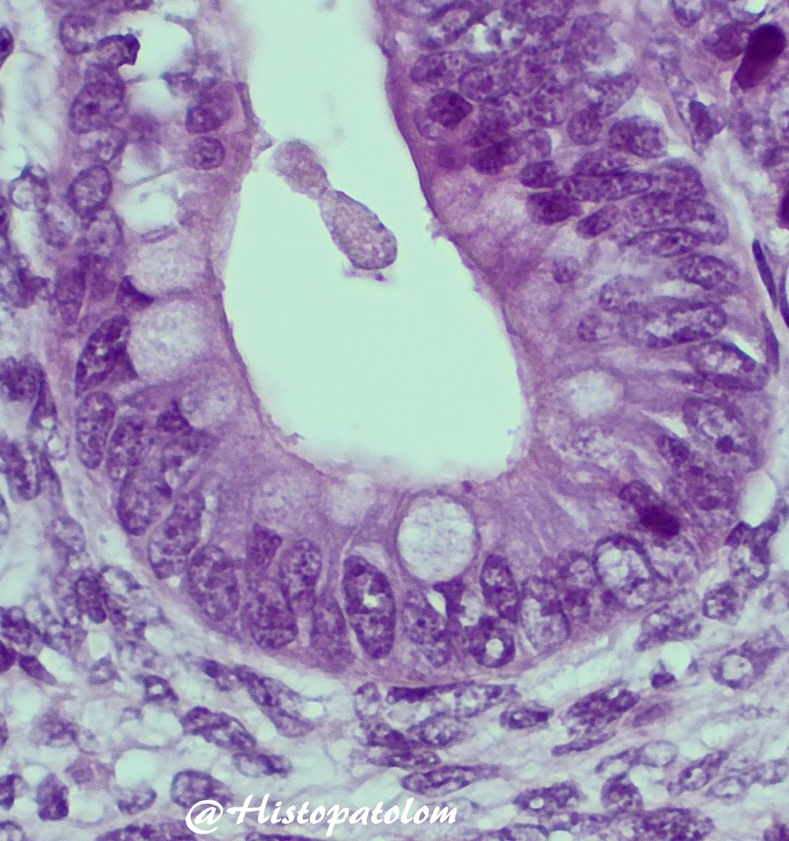 The correct official answer is: No, NoIsolated lymphoid follicles appear at 15-21 weeks and Peyer's patches at 25-29 weeks. As you can see, there is no muscularis mucosae (week 20) but there are goblet cells (week 7)colon (orange), ileum (blue), appendix (black), valve (red)