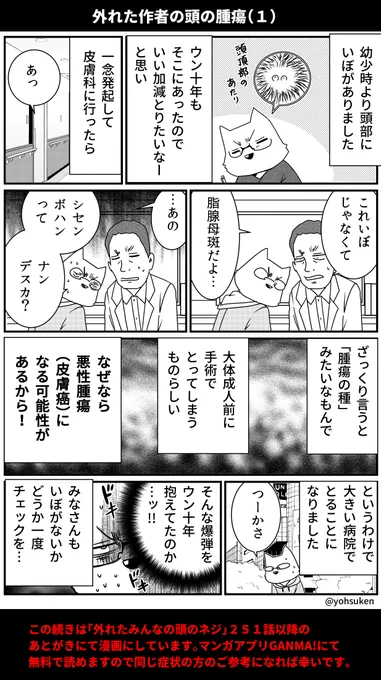 画像は以前にアップした僕の頭部にあったイボが実は悪性腫瘍だったというものなのですが、これを読んだ読者さんが「自分にもある」と病院に行かれたところ、なんと検査で初期の癌も発見されたとのこと…!
「気づかなければ生命に関わっていました」と。
みなさんの注意喚起になれば幸いなので再掲。 