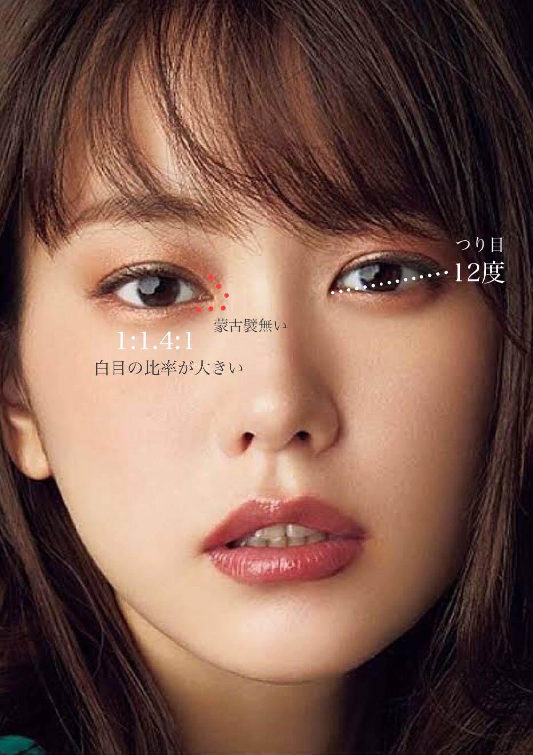 二重整形の名医相談室 埋没法 全切開 目頭切開 眉下切開 眼瞼下垂 目尻切開 下眼瞼下制の失敗 V Twitter ネコ目芸能人 の特徴は白目が大きく 蒙古襞も解消されているところ 涙丘ぎ比較的見えているケースも多い また 目頭から目尻にかけての角度もつり目気味