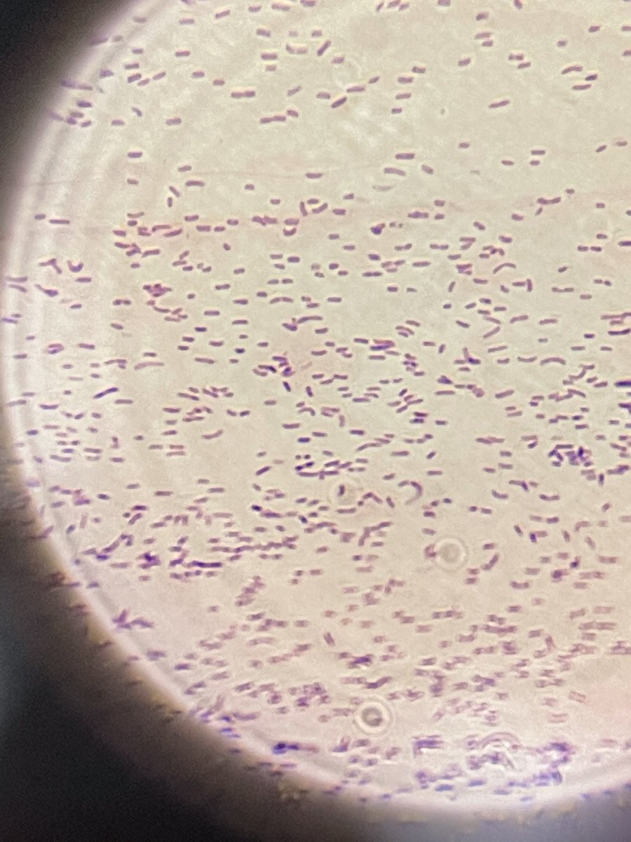 alrziny_labs's tweet photo. اثناء العمل الروتيني في لاب المايكرو شفت ( Contamination) غريب داخل BA جديد مقفل محفوظ في درجة حرارة الثلاجة قررت اسويله Gram stain  وأوريكم اتحفوني بتوقعاتكم عن نوع البكتيريا 💆🏻‍♂️✨ 
I found this contamination in closed new BA in refrigerator and I decided to make a gram stain... https://t.co/nWTxtJXvCA
