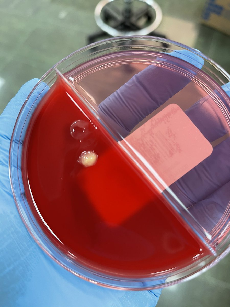 اثناء العمل الروتيني في لاب المايكرو شفت ( Contamination) غريب داخل BA جديد مقفل محفوظ في درجة حرارة الثلاجة قررت اسويله Gram stain  وأوريكم اتحفوني بتوقعاتكم عن نوع البكتيريا 💆🏻‍♂️✨ 
I found this contamination in closed new BA in refrigerator and I decided to make a gram stain...