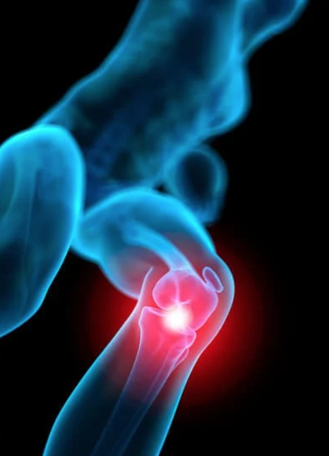 thekneedoc's tweet photo. Are there any exercises for proximal tibiofibular #jointinstability?
There are no specific exercises for proximal tibiofibular joint instability because there are no muscles that can control the joint for most activities of daily living. https://t.co/Z4c4JylBMy #sportsmedicine https://t.co/e00BXS4jOC