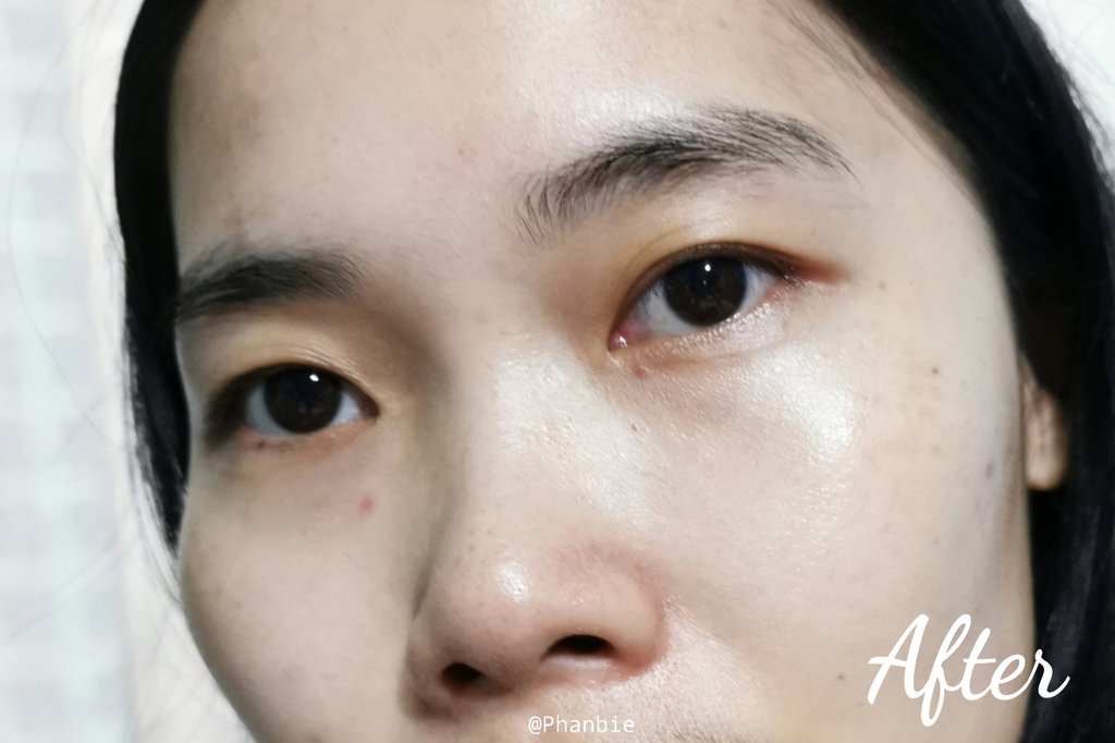 Phanbie's tweet image. ช่วงนี้อินกับส​กินแคร์​ฝั่งเกา​หนักมาก​ ล่าสุดไปเจอตัวนี้มา Junggo All​ Care​ Bubble​ Serum​ ช่วยเรื่องรูขุมขน​ได้โคตรเริ่ด​ รูขุมขน​กระชับ​หน้าเนียนไปเลย​ ละให้ค.ชุ่มชื้น​ดีด้วย​เด้อ หน้าฉ่ำสุดๆ เวลาใช้เซรั่มออกมาเป็นฟองบับเบิ้ล ฟินมาก​ กลิ่นแนวสมุนไพร​ ไปตำเร็วๆ​ #ใช้ดีบอกต่อ