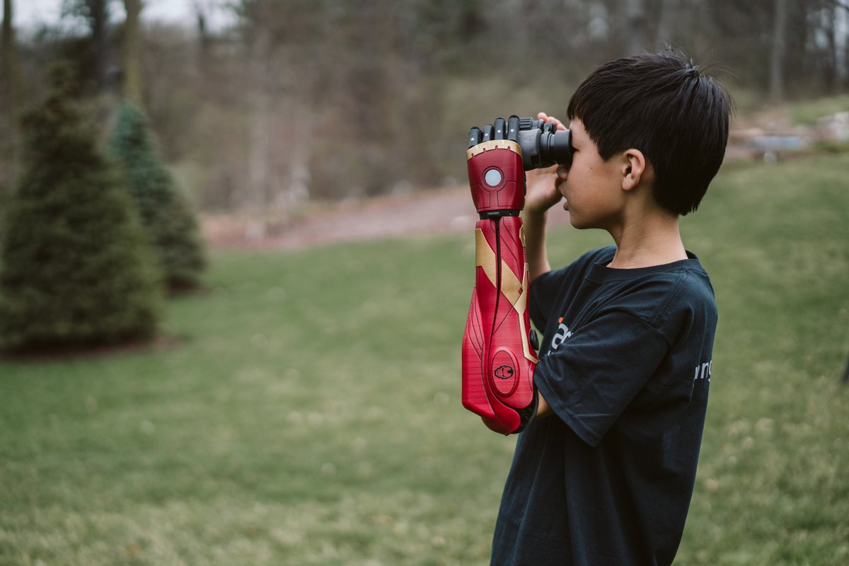 openbionics's tweet photo. We're growing our team in the USA. 🇺🇸🇺🇸🇺🇸 

If you're an upper limb prosthetist looking for a high-impact role with an R&amp;D focus, please apply. We want to work with you! https://t.co/SDfe0vzuGo #hiring #jobs #prosthetics https://t.co/LhgMM82SdX