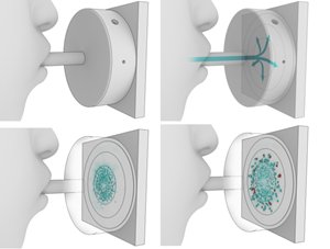 bittertweeties's tweet photo. Game changing technology being brought to market  by @MediVolve $MEDV in partnership with Marvel Diagnostics , welcome to the future of virus detection : Blow Fish a Non-Invasive Exhaled Breath Diagnostic Technology
#COVID19
#FlattenTheCurve

https://t.co/OPy2hMy03Z https://t.co/SgQAGyDz8T