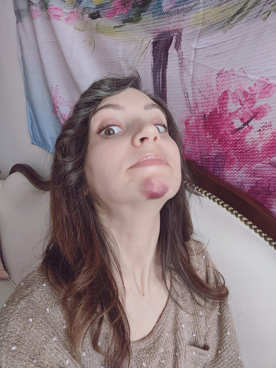 here's a life update since i've been quiet on here lately:
💔 i ended up returning sumi, sadly.
💖 i bought a house!
💔 i learned the importance of safety gear when doing renovations...(pic related)
💖 i started zoloft and it seems to be helping!

overall, i'm doing okay. ✨