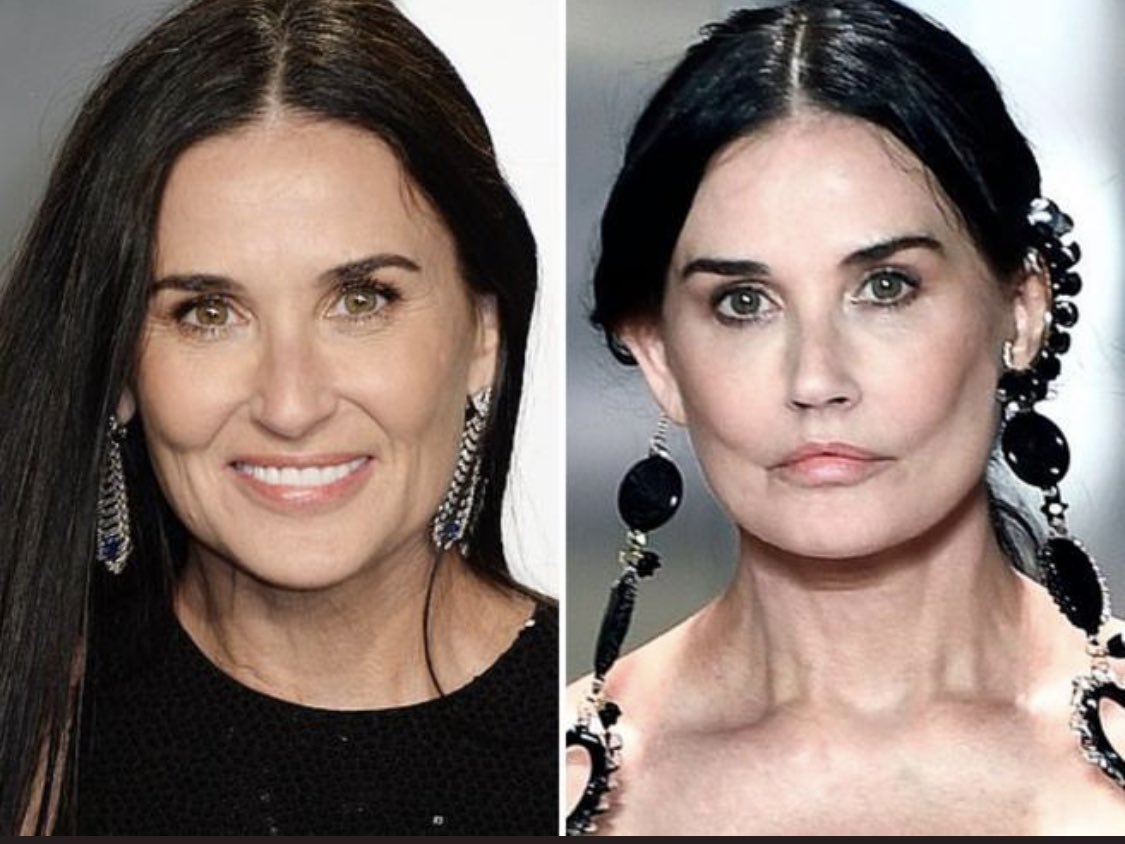 VFijn's tweet photo. Ff beste mensen!
Zie ik het nu verkeerd of heeft de chirurg van #DemiMoore echt te vaak naar #thejoker gekeken?
#fendi @hoeishetmogelijk https://t.co/m4bNmpRnbO