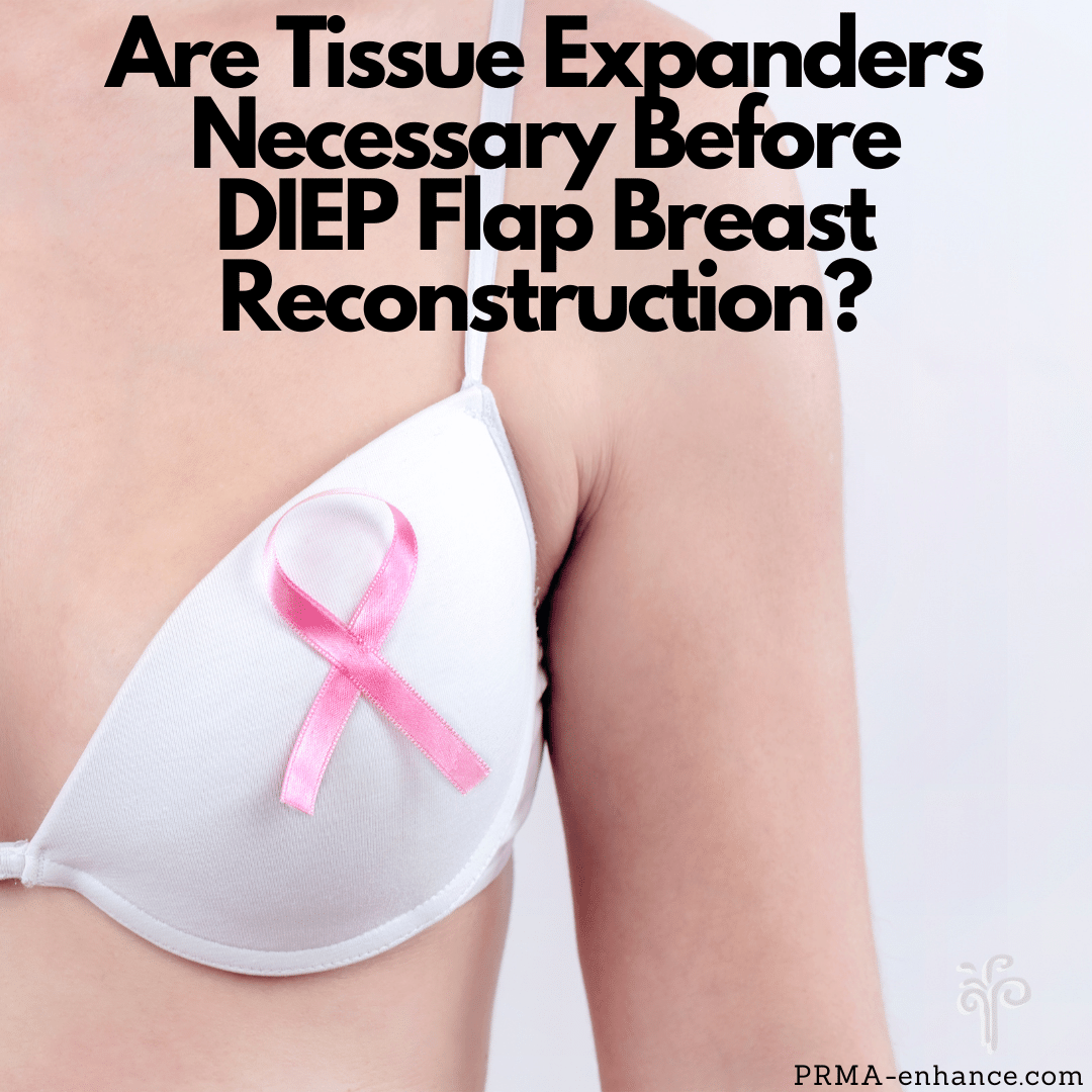 DiepFlapBreast's tweet photo. Are #TissueExpanders necessary before #DIEPflap #BreastReconstruction? Here's what you need to know...https://t.co/7sP93kJc1p
#RebuildingLives after #BreastCancer
#PlasticSurgery #bcsm https://t.co/bta0dIrkhP