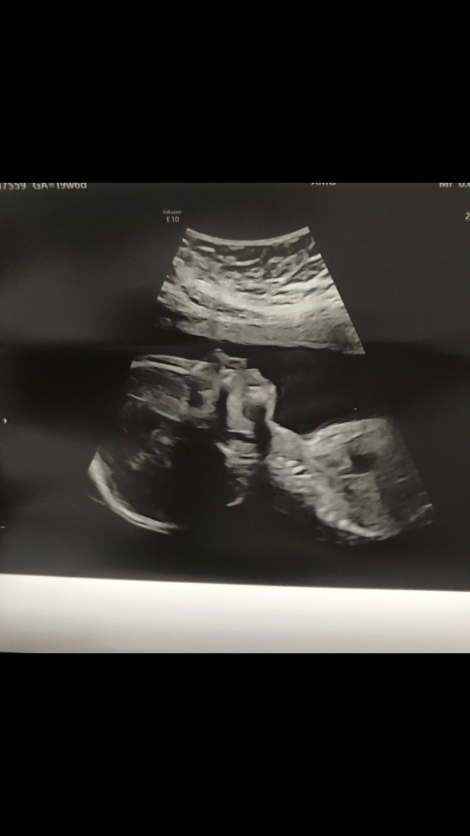 motobks8's tweet photo. So beyond excited to be welcome my little boy into this world maverick James schlegel May 18th 2021 @Padres #futurepadre https://t.co/PhdDwBdsKj