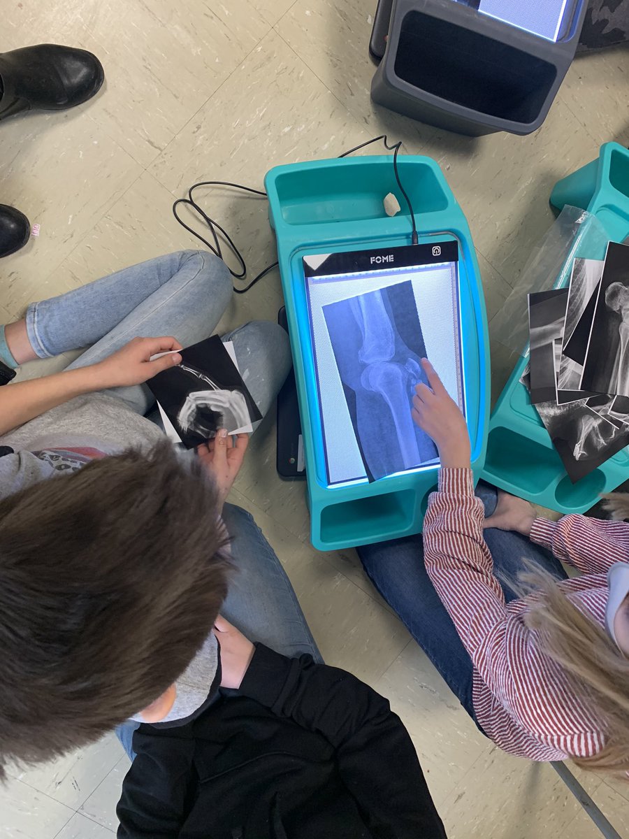 Ms_Lauther's tweet photo. Today we explored the skeletal system Some activities included a magnetic skeleton puzzle and analyzing x-rays. Lots of oohs and aahs and “look at that break!” https://t.co/8WUiXQuwK9
