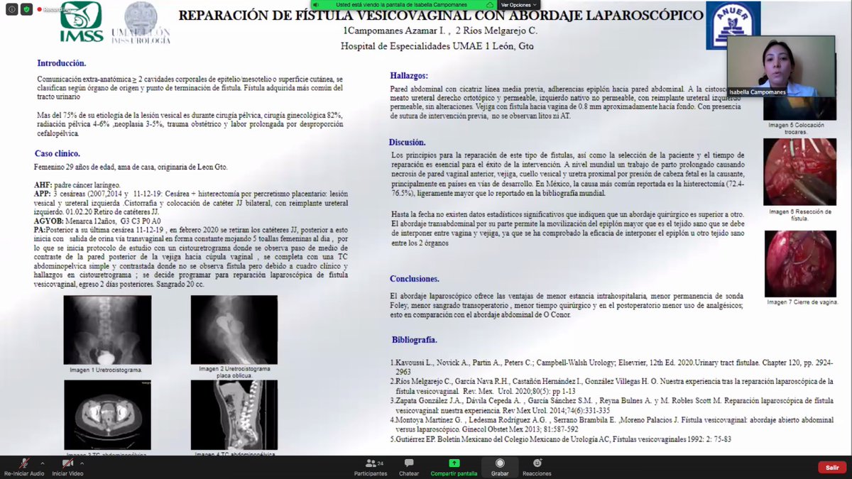 BonillaUro's tweet photo. Presentación de trabajos libres y casos clínicos en #ANUER online @anuermx, @Urologia_UMAET1 presente https://t.co/MXx1YXZSsJ