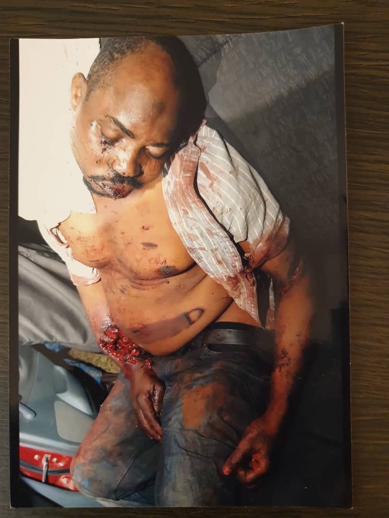 The final straw that led to Igboho going into the place. This is Dr. Aborode who was killed for complaining that herders destroyed his 400 acre cashew farm. The killers are still out there....somewhere. Gov Makinde must find the killers.