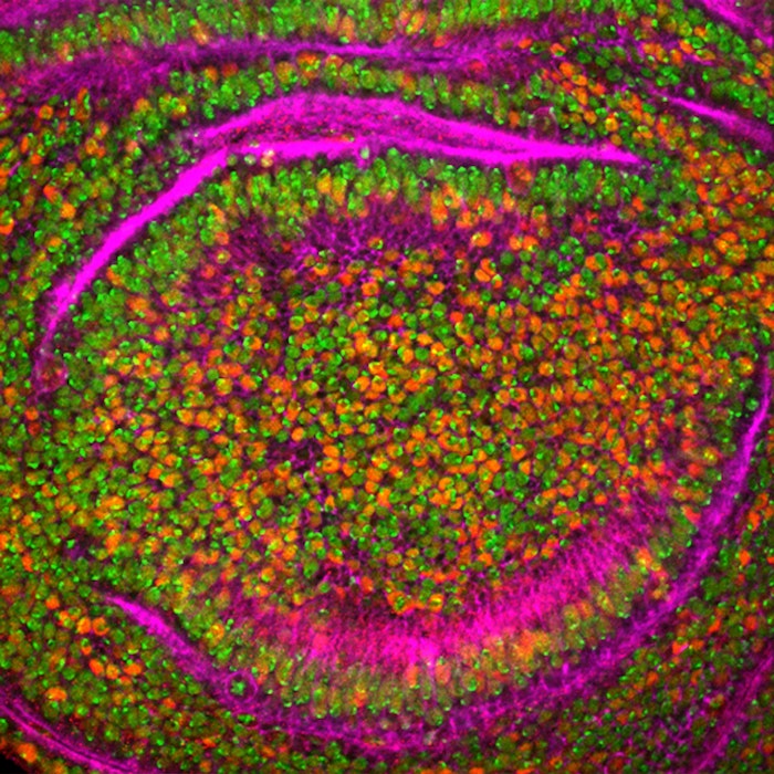 knowinnovation's tweet photo. KICKOFF EVENT TOMORROW: Shape the future of #RadiationOncology at our March virtual workshops. Team up with cancer/radiation scientists & computer/math researchers. @theNCI, @ENERGY & #FredNatLab Register for the KICKOFF, see exact March dates and apply https://t.co/WponP7fD5U https://t.co/FXaWkW96tW