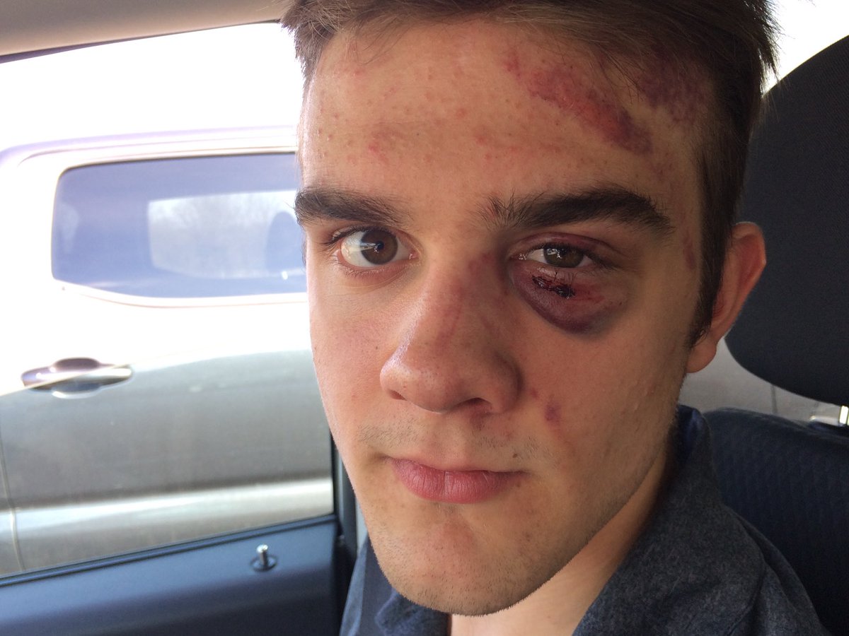 #BellLetsTalk about my sons first game with the ⁦<a href="/JrCThistles/">Fergus Thistles Jr C Lacrosse</a>⁩ at the Nations.I didn’t know whether to laugh or cry 😳😊 Lessons learned. ⁦<a href="/HyattWelsh/">Hyatt welsh</a>⁩ you did help keep me calm as I recall. #LoverNotAFighter ? 🤔 @#BellLetsTalk