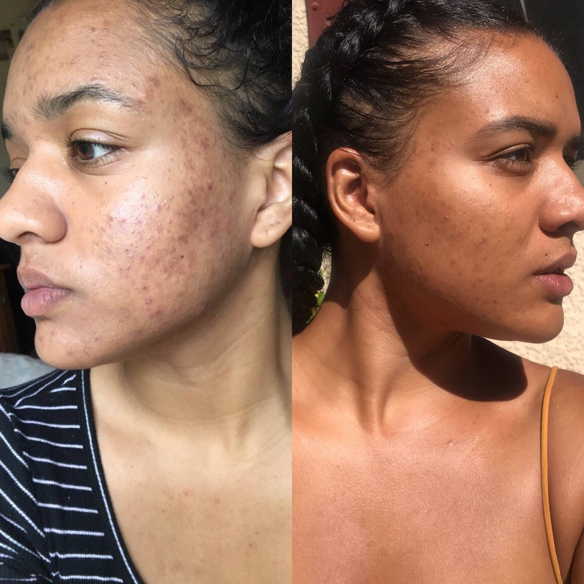 Lastly, The lovely rose water face dew [$15.00][Key ingredients]-Rose centrifolia flower extract (rose water)-Radish root-Rosa Canina Seed (rose hip oil)-Rosa Centifolia Flower Extract