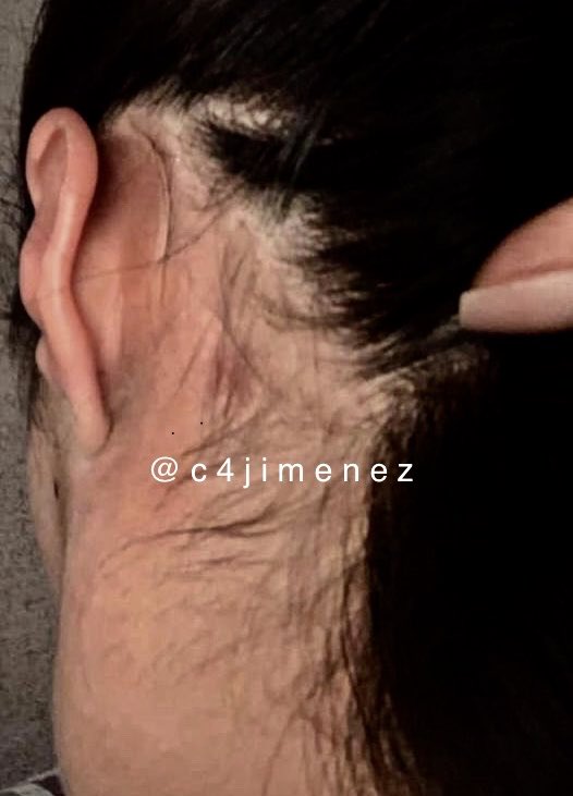 GOLPEÓ a SU PAREJA… y AHORA BALEÓ su CASA
Es José Bobadilla Sanabria
Así dejó lesionada a Ivonne cuando eran novios.
Ahora q lo terminó y lo denunció, él baleó su casa.
Amenaza con matarla a ella y a su familia.
La <a href="/FiscaliaEdomex/">Fiscalía Edoméx</a> ya lo investiga.
Si lo ubica, denúncielo!