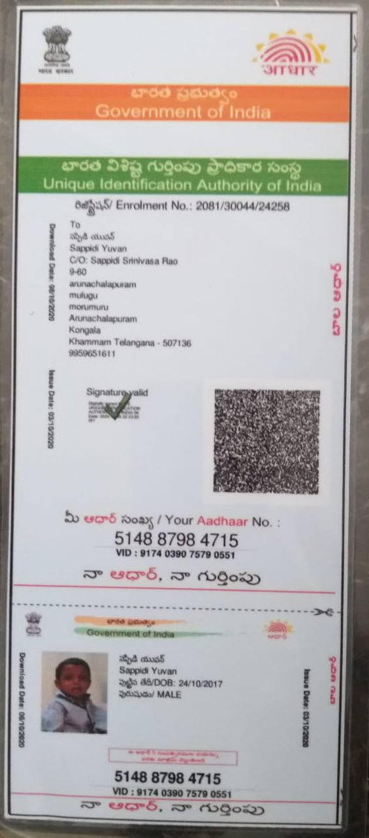 kamerakranthi's tweet photo. @KChiruTweets  #దయచేసిసహాయంచేయండి Sir, పేరు. S. యువన్ age 3yrs నిరుపేద కుటుంబం, #livertransplantation చేయాలి అన్నారు, #అపోలో హాస్పిటల్ లో చికిత్స పొందుతున్నారు. Please #HelptosaveYuvan sir...Tq u sir urs Kranthi founder #Yuvabharathshakthifoundation https://t.co/1jhp9taLZ2