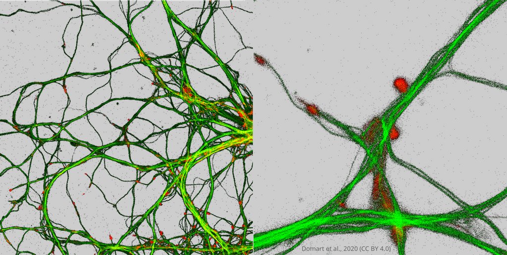 Researchers have succeeded in the difficult task of imaging metals together with proteins at the synaptic level. Their findings have revealed the interaction of copper and zinc with the synaptic architecture of neurons elifesciences.org/articles/62334…