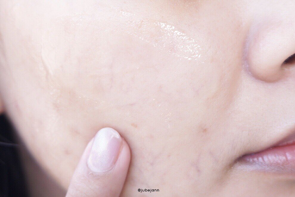 jubejann's tweet image. ช่วงปจด.ใกล้มา สิวก็ตามมาด้วย เราใช้เจลใบบัวบกของ The Ingredients พอกหนาๆก่อนนอน มีสปก.ใบบัวบก+ว่านหางจระเข้🍃 ช่วยปลอบผิวดีมาก ลดสิว ผดผื่น รู้สึกว่าผิวมันน้อยลงด้วย ไซส์ 50g ซองละ 49.-  #เจลใบบัวบก #ใช้ดีบอกต่อ