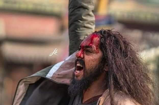 GurlalSingh1134's tweet photo. Pictures depicting Singh's ascendancy !! The turban is worn !! Singh himself is injured !! But the slogans of Chardikala come out of the mouth !!

Kisaan ekta jindabad

#SinghuBorder https://t.co/32ttjQa1Qq