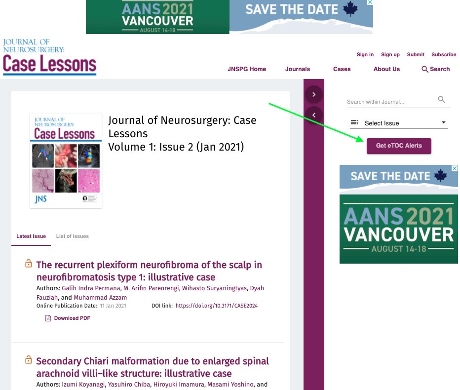 TheJNS's tweet photo. How can you ensure you don’t miss the latest and greatest from #JNS #CaseLessons? Sign up for the E-Table of Contents (eTOC)!
Log onto https://t.co/QMoFI3nJRL
Click on the “Get eTOC Alerts” button in the right-hand column - see below https://t.co/Q8bvm4kRy4