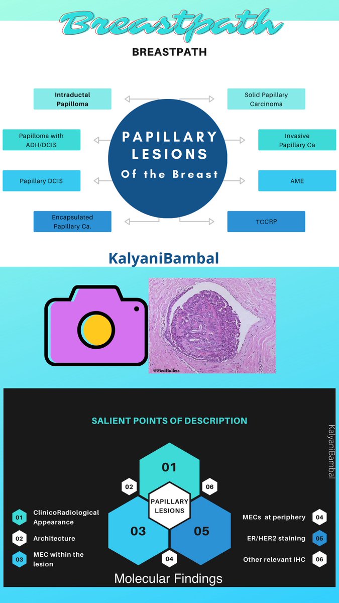 Infographics I made for Papillary Breast Lesions.Check out more in the thread below  #breastpath  #residents  @smlungpathguy  @JMGardnerMD  @nucleololailo  @ariella8  @thejourneymate  @DrGeeONE  @vi_monappa  @DraEosina  @Dramanyhassany1  @Alipathy  @luishcruzc