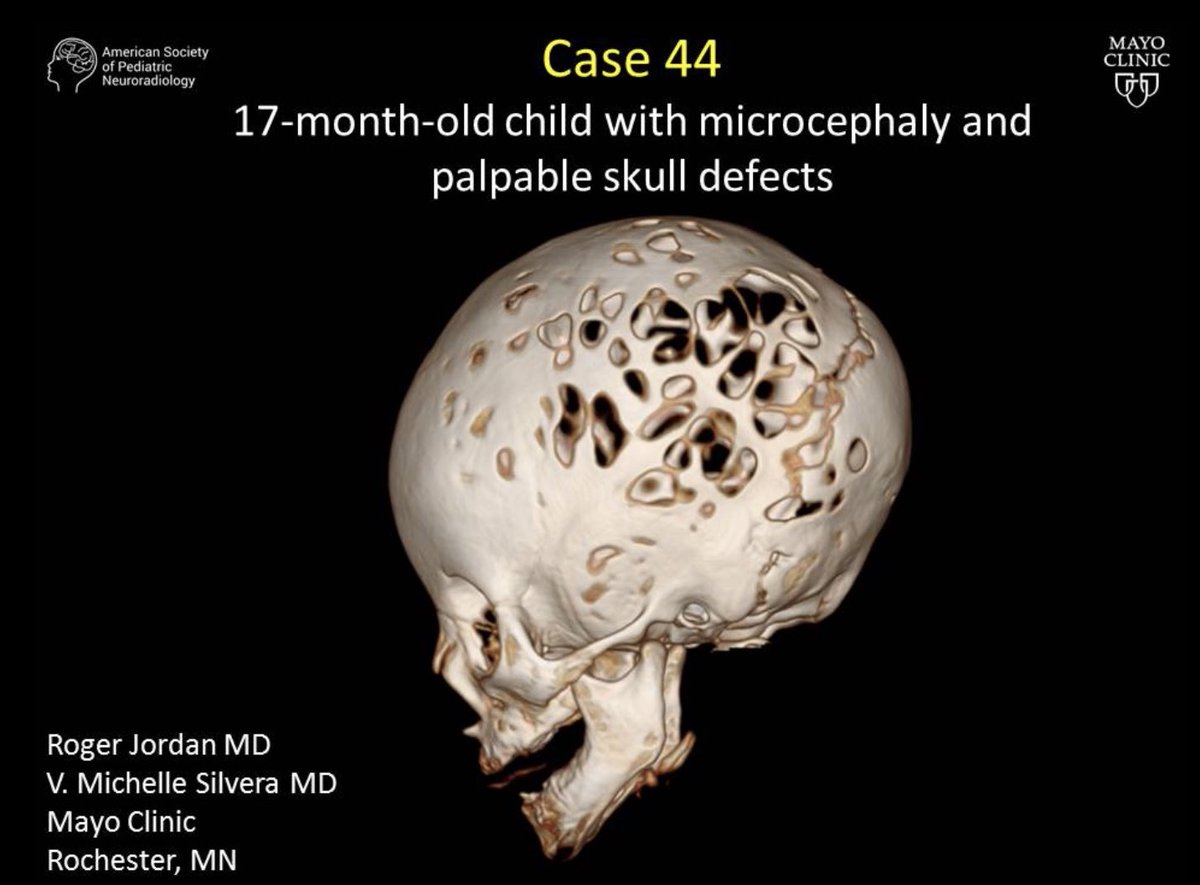 American Society of Pediatric Neuroradiology tweet media