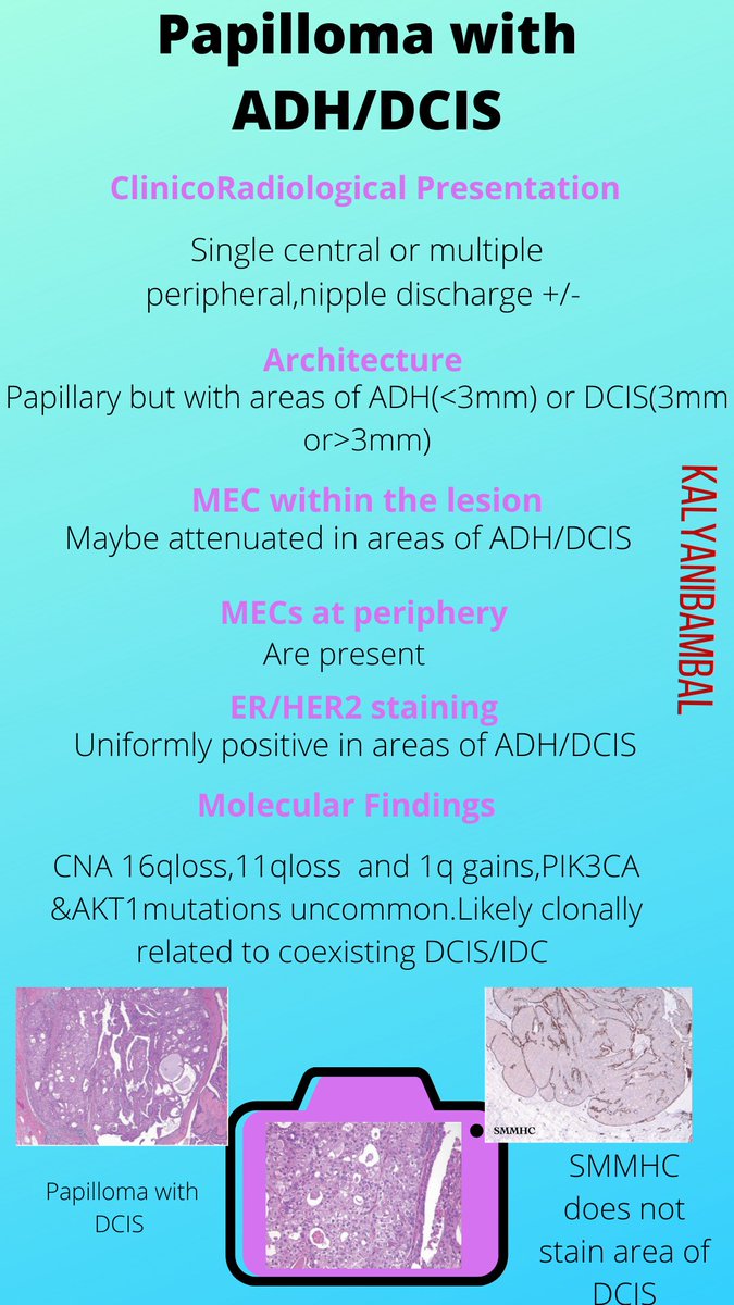 Infographics I made for Papillary Breast Lesions.Check out more in the thread below  #breastpath  #residents  @smlungpathguy  @JMGardnerMD  @nucleololailo  @ariella8  @thejourneymate  @DrGeeONE  @vi_monappa  @DraEosina  @Dramanyhassany1  @Alipathy  @luishcruzc