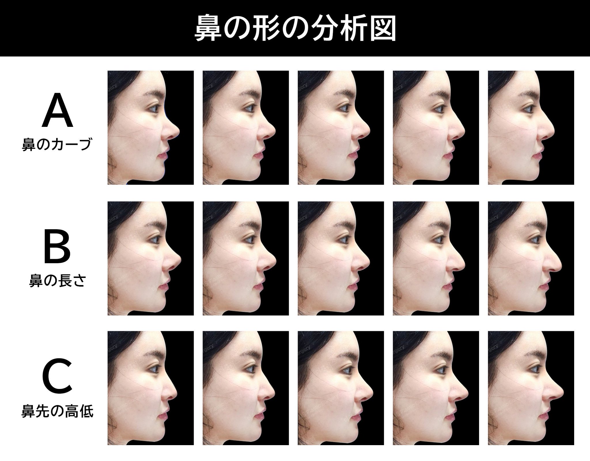 ザ·プラス整形外科のキム·テッキュン博士です。(THE PLUS