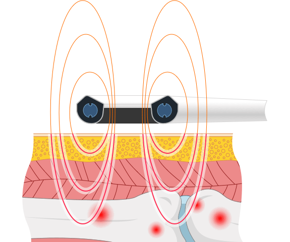 WHAT IS THE EXTRACORPOREAL MAGNETIC TRANSDUCTION THERAPY?

nydnrehab.com/treatment-meth…