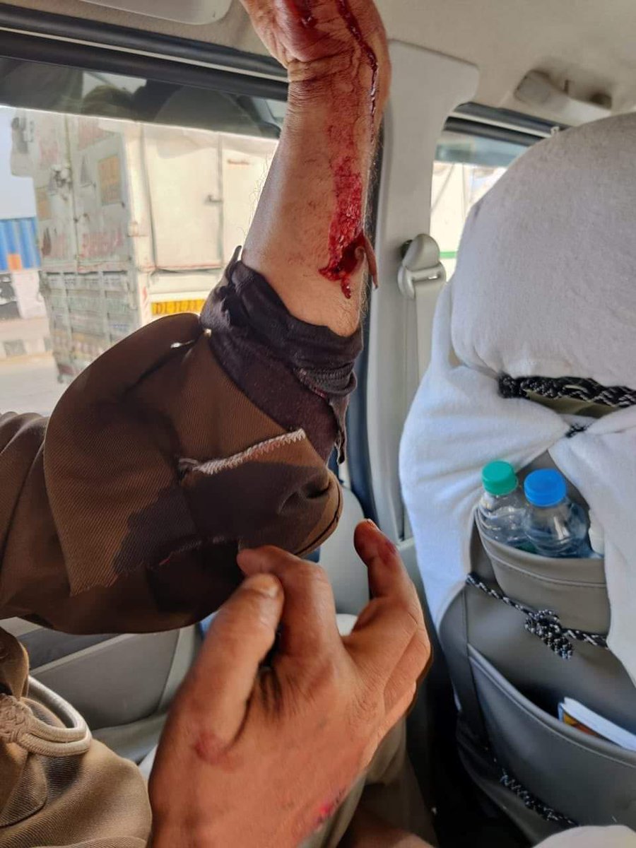 INeetuDabas's tweet photo. वो तो शुक्र है ये हाथ एक पुलिसवाले का है,
गलती से किसी फ़र्ज़ी किसान का होता, तो रुदालियों की अश्रुधारा बह निकलती और चूड़ियों के टूटने की आवाज़ सुप्रीम कोर्ट तक को सुनाई दे जाती। https://t.co/KGtnPMjUQm