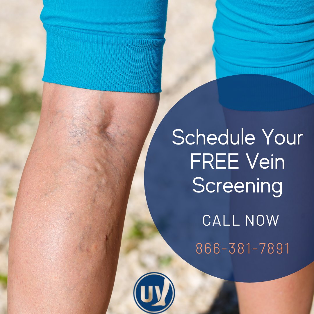 Varicose and spider veins can be indicative of a condition called chronic venous insufficiency which can cause pain and swelling in your legs. 

Schedule your FREE screening. 

866-381-7891 bit.ly/2ISErC7 
#UnitedVeinCenters #VeinClinic #VeinDoctor #VaricoseVeinTreatment