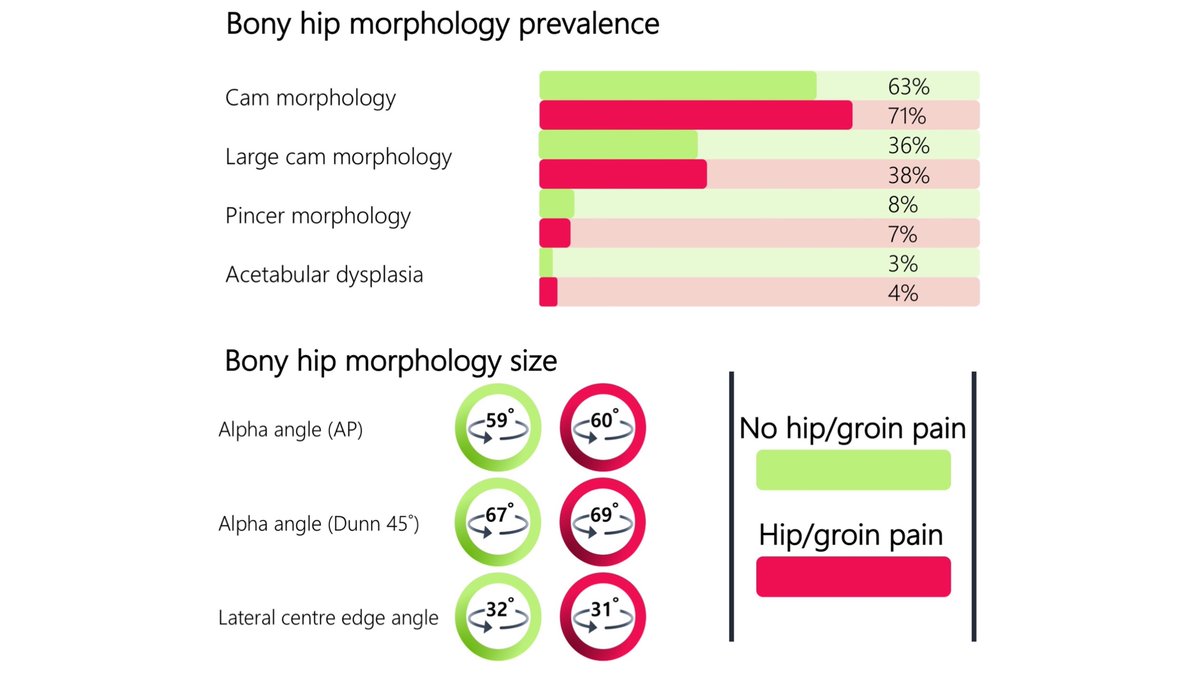 Some important work here <a href="/LaTrobeSEM/">La Trobe SEMRC</a> on football players #HipAndGroinPain. Stats revealing size &amp; prevalence of bony hip morphology IS similar in those with &amp; without hip/groin pain! Emphasizing treat the patient not the scan painhttps://www.jospt.org/doi/10.2519/jospt.2021.9622