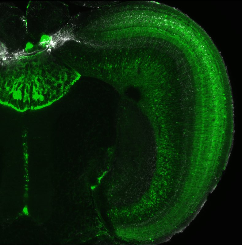 Holly Gibbs (@holly_c_gibbs) on Twitter photo I fell in love with microscopy and couldnāt give it up. Hereās an adult zebrafish midbrain from @ArneLekven cleared with passive clarity technique protocol from @dylan_mccreedy on a Zeiss Z1. What IS the structure of all those circuits I wonder? š #ImagingTheFuture <a href="/cziscience/">CZI Science</a> I fell in love with microscopy and couldnāt give it up. Hereās an adult zebrafish midbrain from @ArneLekven cleared with passive clarity technique protocol from @dylan_mccreedy on a Zeiss Z1. What IS the structure of all those circuits I wonder? š #ImagingTheFuture <a href="/cziscience/">CZI Science</a>
