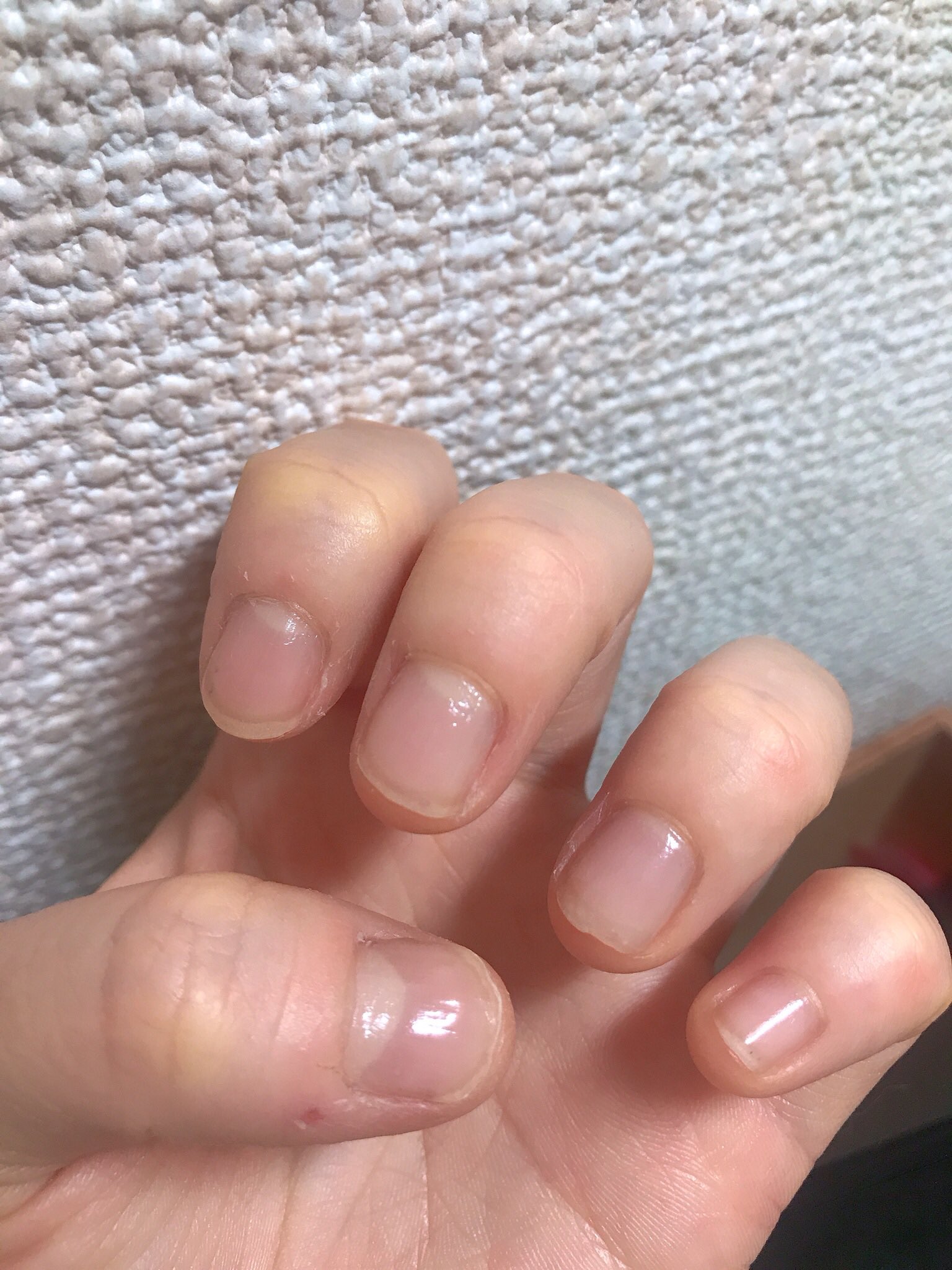 やち 育爪日記 C9o Fv Twitter