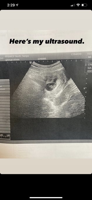 This abortion has been hell, my mental is fucking plummeting so send positive energy please https://t