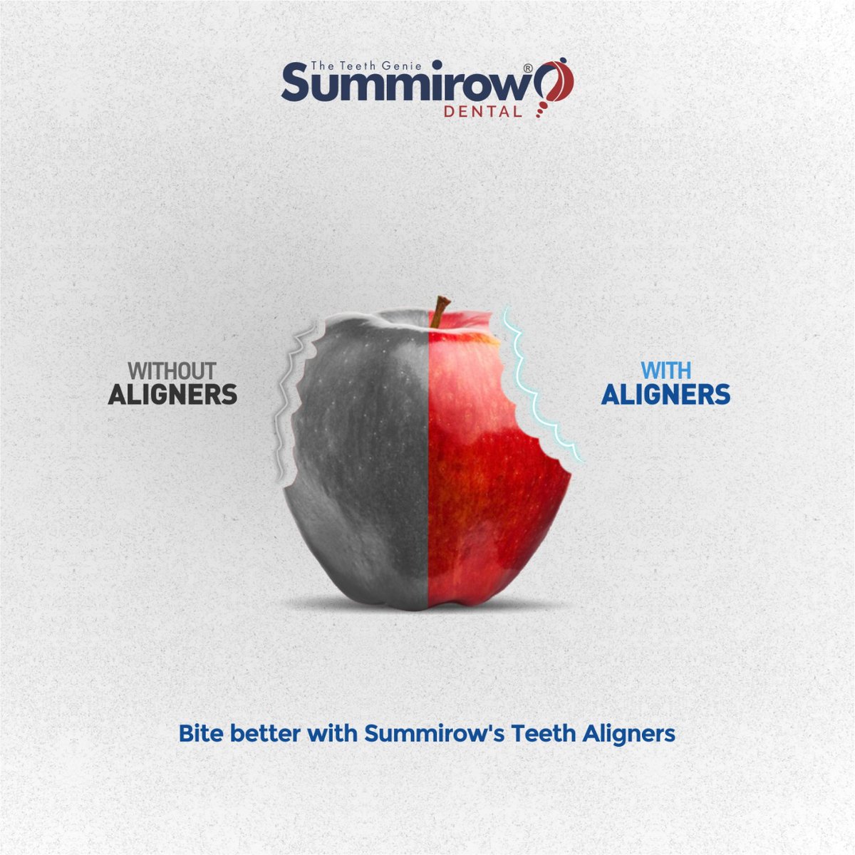 SummirowDental's tweet photo. Do your teeth need to be aligned? Are your teeth not in the place they should be? Then, there is a simple answer to your problem. Summriow Teeth Aligners. Try it!
https://t.co/RrzCBlc04N
#teethaligners #aligners #toothaligners #dentist
#dentistnearme
#teeth
#dentalimplants https://t.co/n8SOCoDEyx