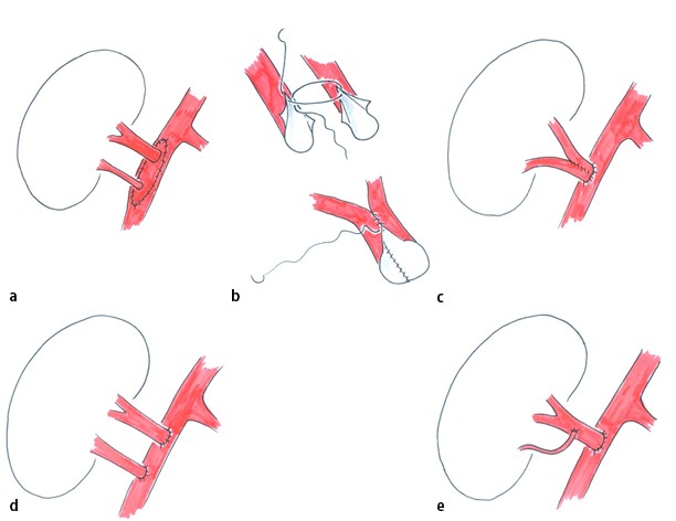 Diederik Kimenai tweet media