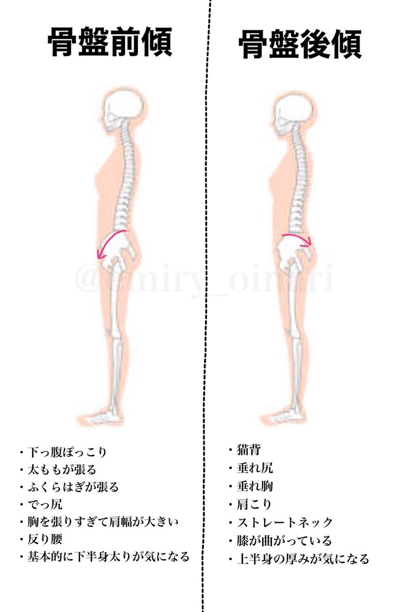 トレえみ 骨盤 の前傾後傾がそもそもわからない という声があったのでどちらに傾くと前傾か後傾かイラストにしておきます 昨日ツイートした脚の開き具合で骨盤を見た方でこの2つに当てはまる方 この様な問題はないでしょうか トレえみ 骨盤 の前傾後傾がそもそもわからない という声があったのでどちらに傾くと前傾か後傾かイラストにしておきます 昨日ツイートした脚の開き具合で骨盤を見た方でこの2つに当てはまる方 この様な問題はないでしょうか