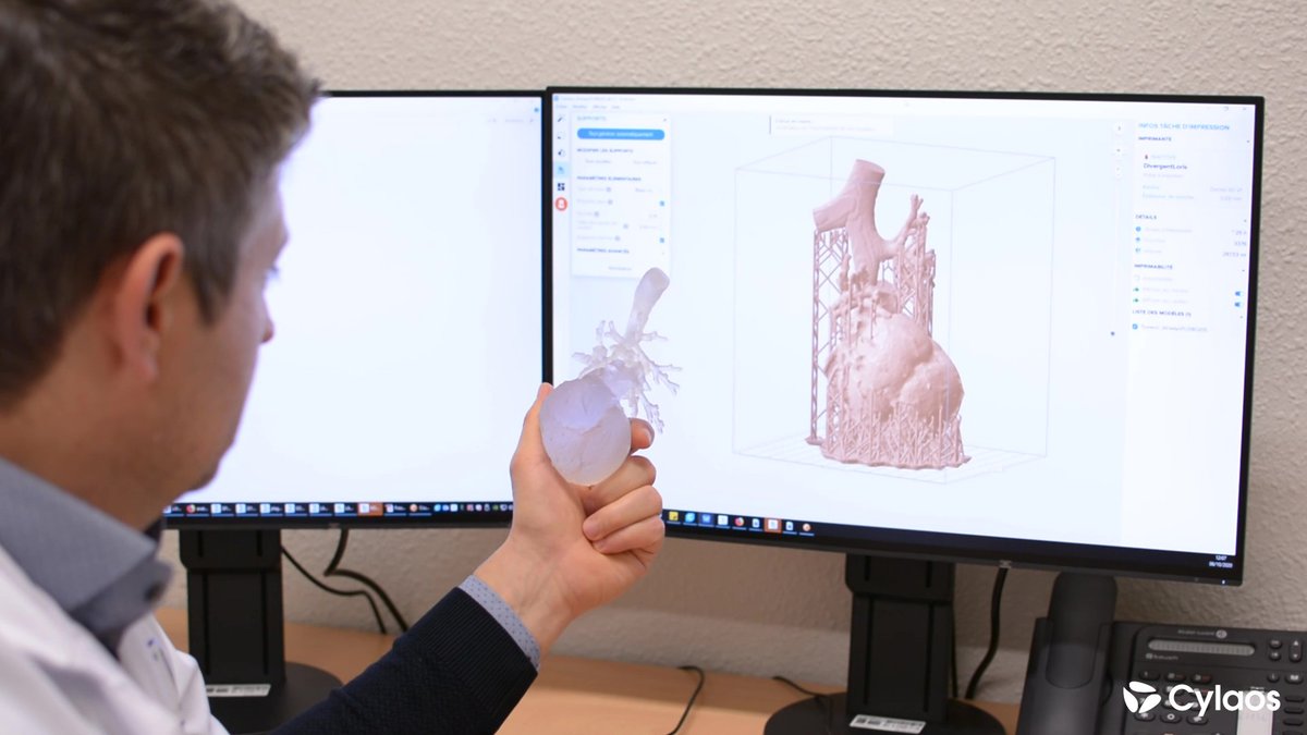 Chirurgien maxillo-facial au sein du CHRU de Besançon le docteur Aurélien Louvrier utilise aujourd'hui les imprimantes 3D SLA Formlabs pour la préparation de ses interventions.

Découvrez dans le lien ci-dessous les raisons de son choix !

cylaos-medical.fr/blog/chru-besa…
