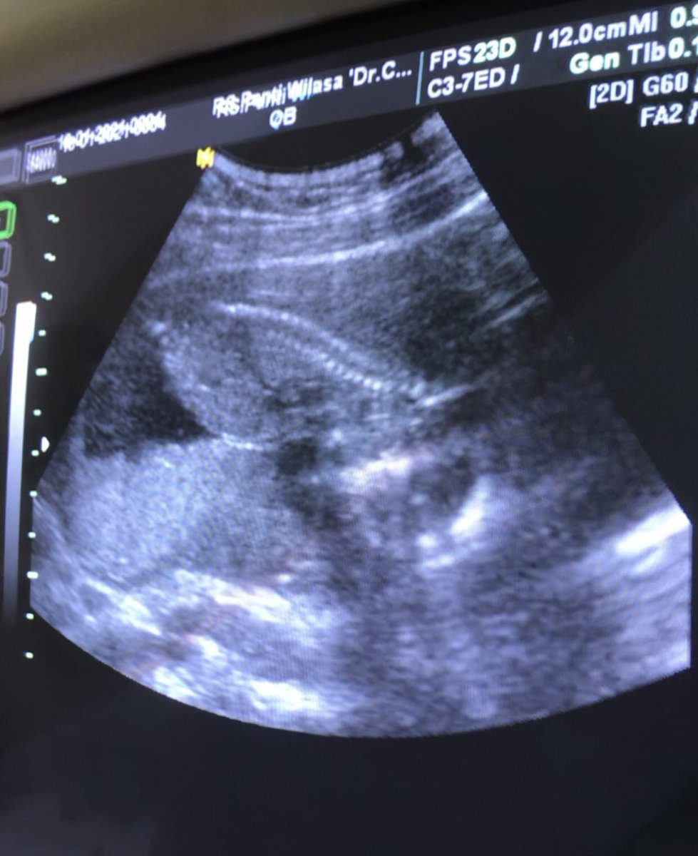 Nak kok gemesin sih, ada atraksi nungging segala 🤣🤣 bunda jadi gemes 😘😘