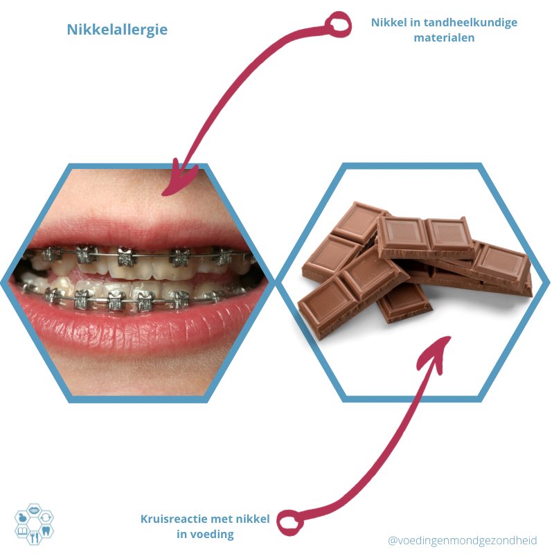 Kruisreacties met voeding bij nikkelallergie komen gelukkig maar zelden voor. Maar voor die zeldzame patiënt is het toch fijn dat jij ze verder kan helpen toch?
#gezondemond #mondhygienist #mondhygiënist #mondhygiene #mondzorgkundestudenten