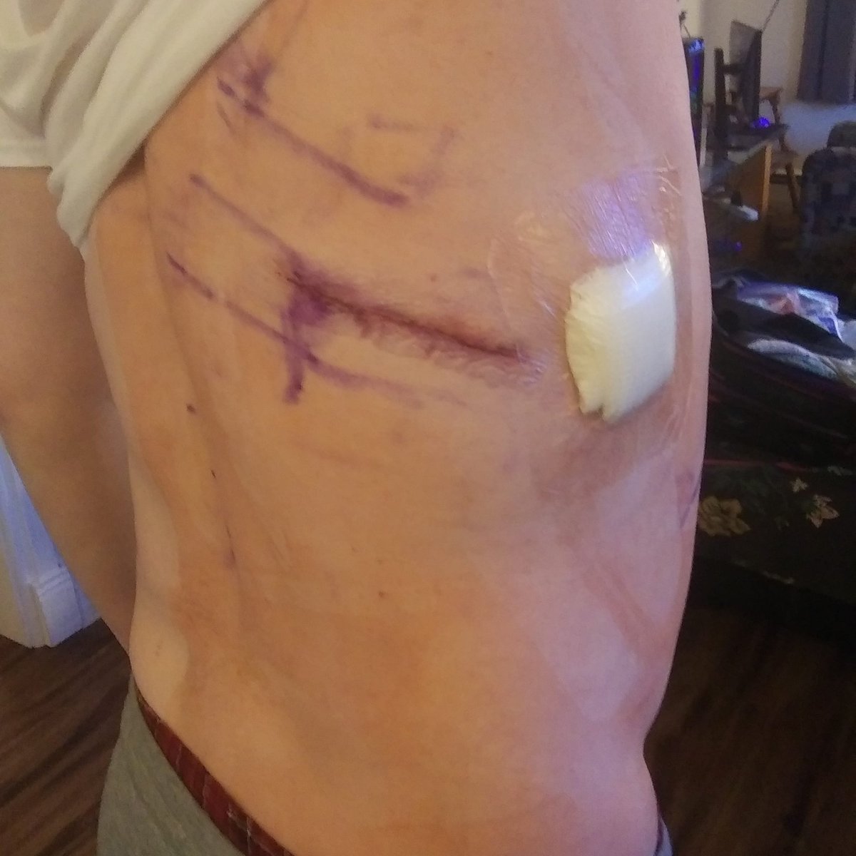 macblunts's tweet image. Sigh...  This hurts.