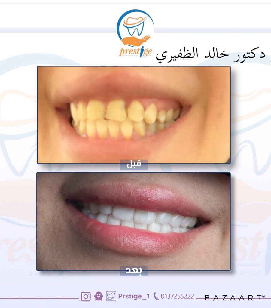 برستيج لطب الاسنان Prstige 1 Twitter