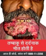 ayadav24's tweet photo. Thank you @narendramodi @PMOIndia and @drharshvardhan @iamvikassheel @MoHFW_INDIA for proposing the life-saving amendments to #COTPA #I_Support_COTPA_Amendment_Bill_2020. #TobaccoKills #Cancers #Impotence #HeartAttack #Diabetes #SIDS #infertility #TobaccoCausesPainfulDeaths https://t.co/o7ya53Ca9M