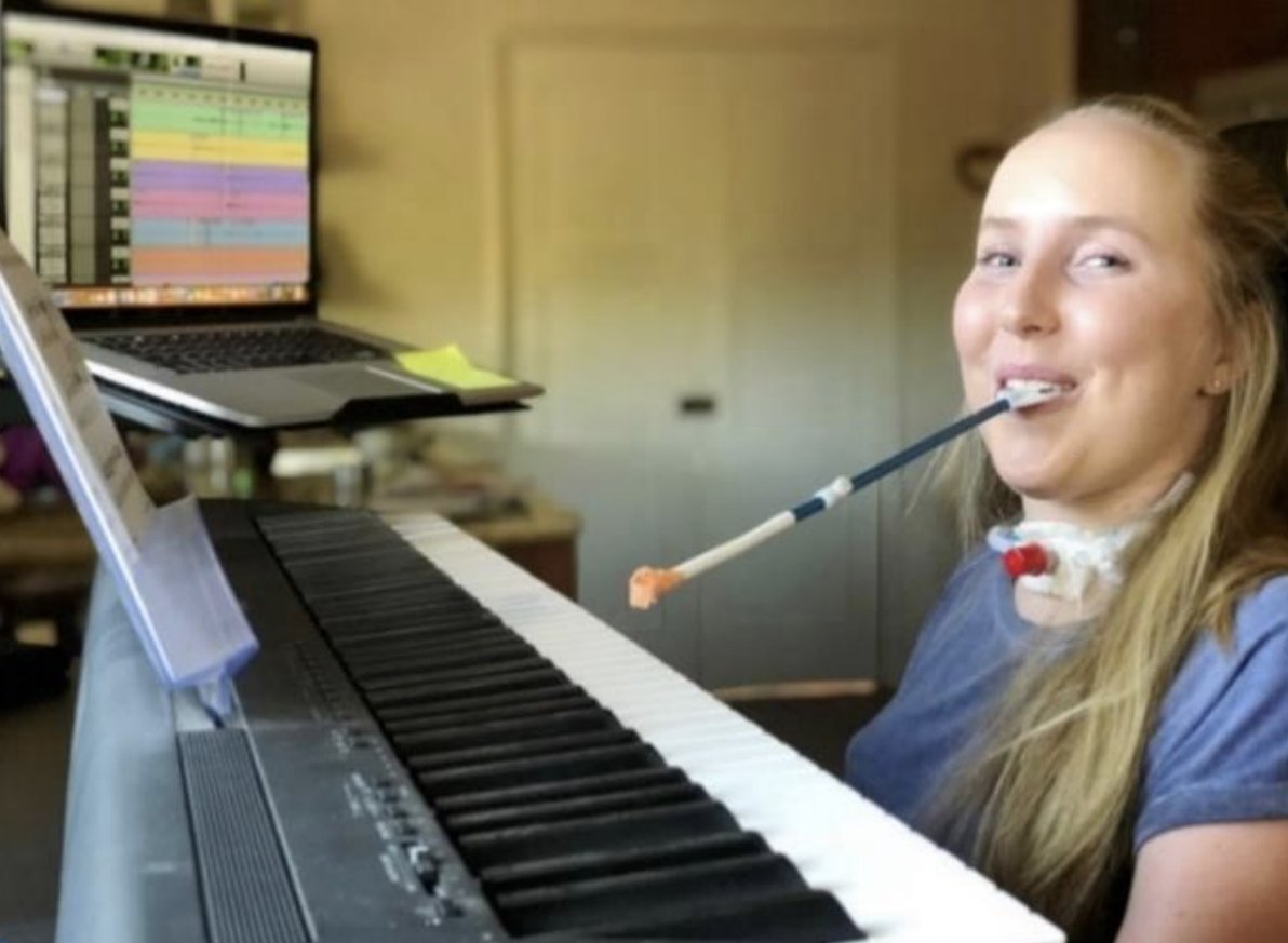 theOThub's tweet photo. 🎹🎨 Healing the Mind and Soul with Art and Music

A rare neurological condition left Gracie paralysed from neck down. 'With the right environment, tools and supports, anyone can create.' 

Plus+ Members - visit your RESEARCH PORTAL: https://t.co/4Kg1iArlNt #OccupationalTherapy https://t.co/PIzuZEpIgC