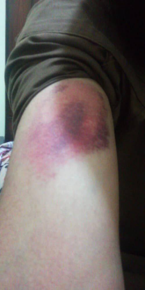 panjutha1's tweet photo. injustice anywhere is a threat to justice everywhere. These heinous acts of state can’t hinder the flow of resistance. we condemn this police gardi.
#NUMLians_under_Police_torture
 #StudentsRejectPhysicalExams https://t.co/ZE7HPoUtYN