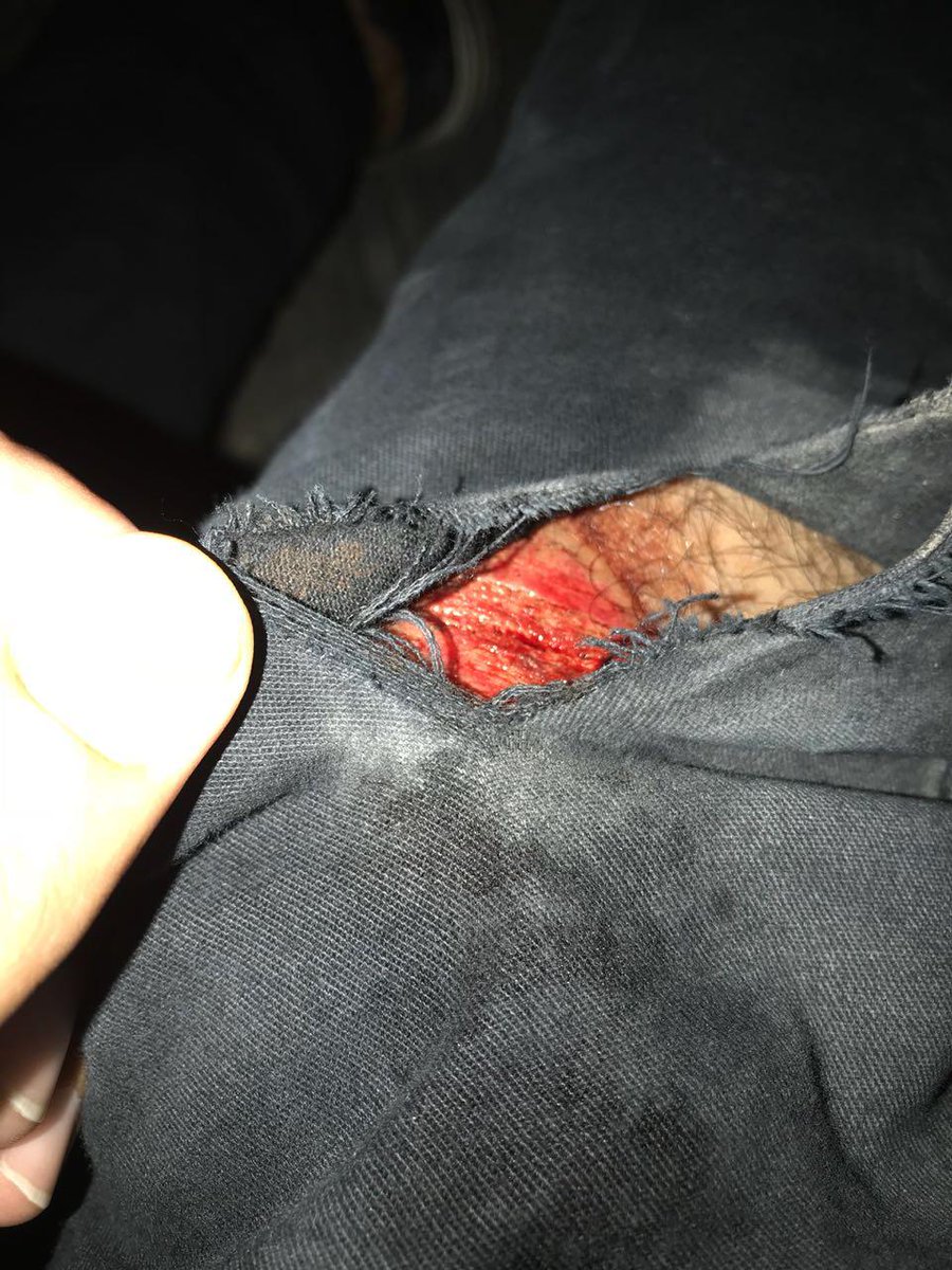 SyedaFa67956660's tweet photo. #NUMLians_under_Police_torture
#HelpUsAliBaqarNajafi https://t.co/G2wEwnmlf3
